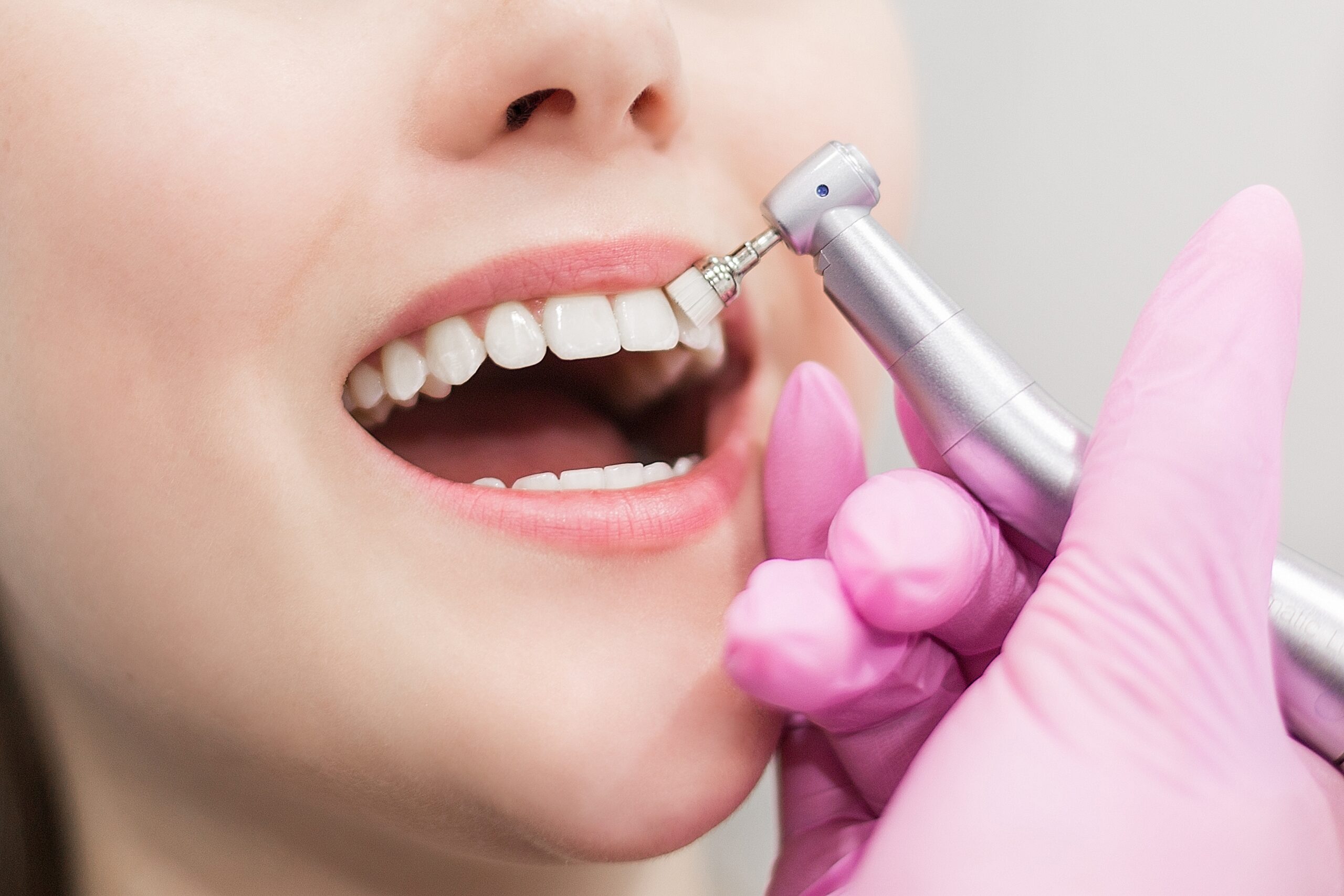Teeth Whitening Gold Coast Dentist